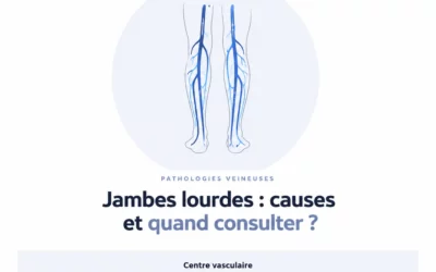 Jambes lourdes : causes et quand consulter un médecin vasculaire ?