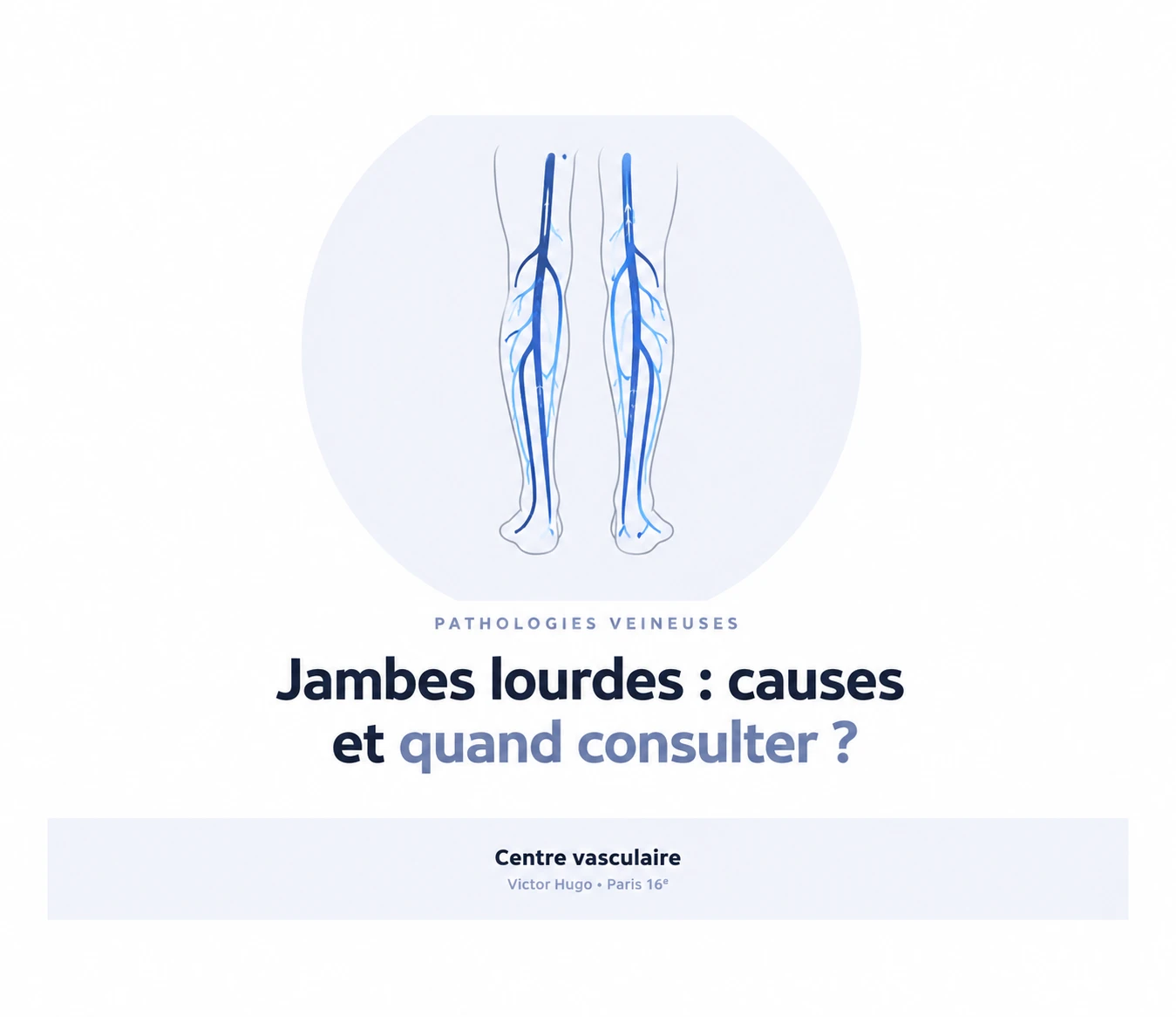 Jambes lourdes : causes et quand consulter un médecin vasculaire — illustration du réseau veineux des jambes, Centre vasculaire Victor Hugo