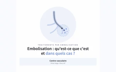 Embolisation : qu&rsquo;est-ce que c&rsquo;est et dans quels cas est-elle proposée ?