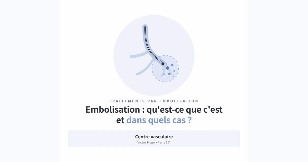 Vignette sociale — Embolisation Embolisation : un cathéter guidé par imagerie largue des microbilles dans les vaisseaux d'une lésion